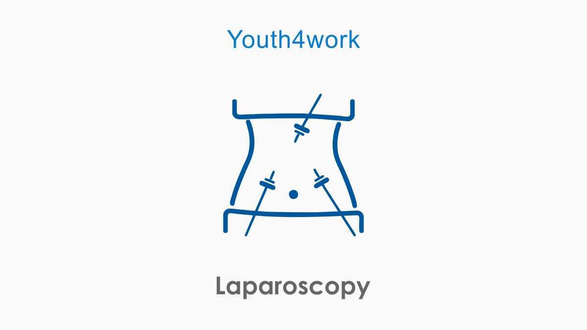 Laparoscopy